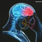 تعرف على مرض باركنسون وما سبب الإصابة به